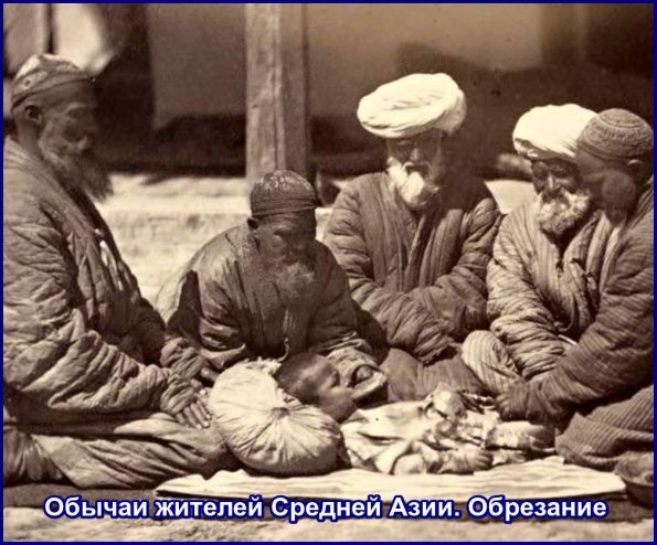 1910 Предпл Сырдарья Обрезание