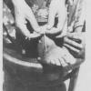 1925 Бухара Извлечение Ришты Табибом